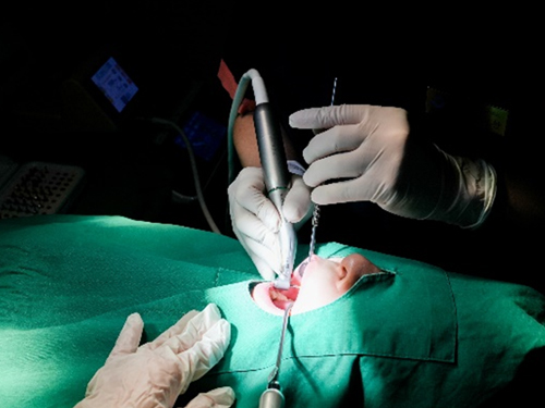 임플란트 식립 및 보철물 결합